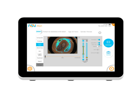 Cervical Mapping Reimbursement