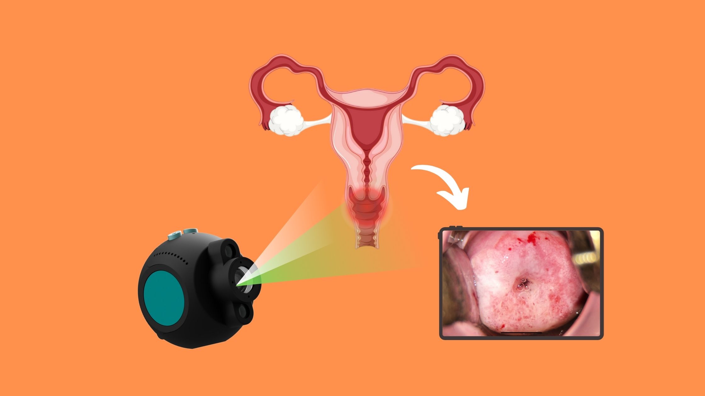 How nGyn’s AI-Powered Colposcopy Is Changing Women’s Healthcare